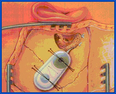 cirurgia