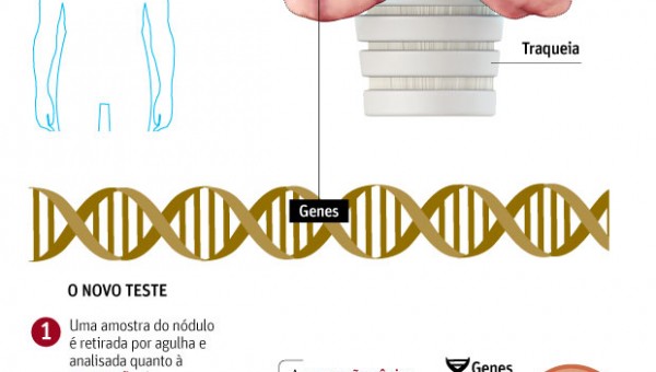 grafico