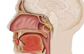 Hipertrofia de adenoides: o que é? Quais as causas? E os sintomas? Como são o diagnóstico e o tratamento? Existe prevenção? oto